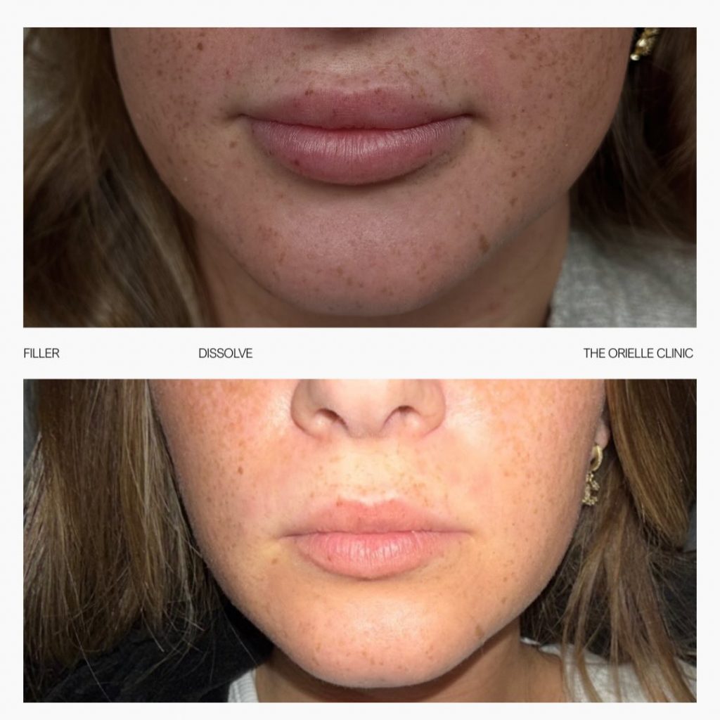 Instagram post from orielleclinic. This post is in position 0.