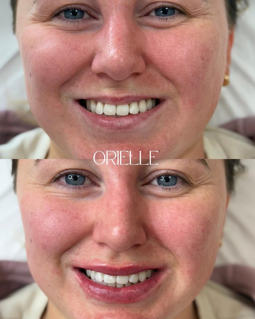 Instagram post from orielleclinic. This post is in position 2.