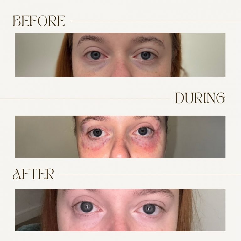 Instagram post from orielleclinic. This post is in position 2.